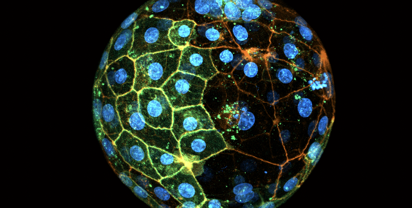 A spherical shape with bright green dots on the left hand side
